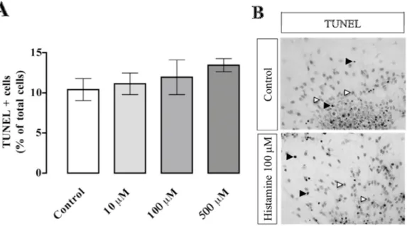 Figure III. 2. Histamine does not exert any effect on cell survival of SVZ cell cultures
