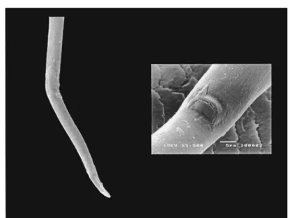 Fig. 2. Scanning electron micrographs of Bursaphelenchus xylophilus female tail and vulval flap (inset).
