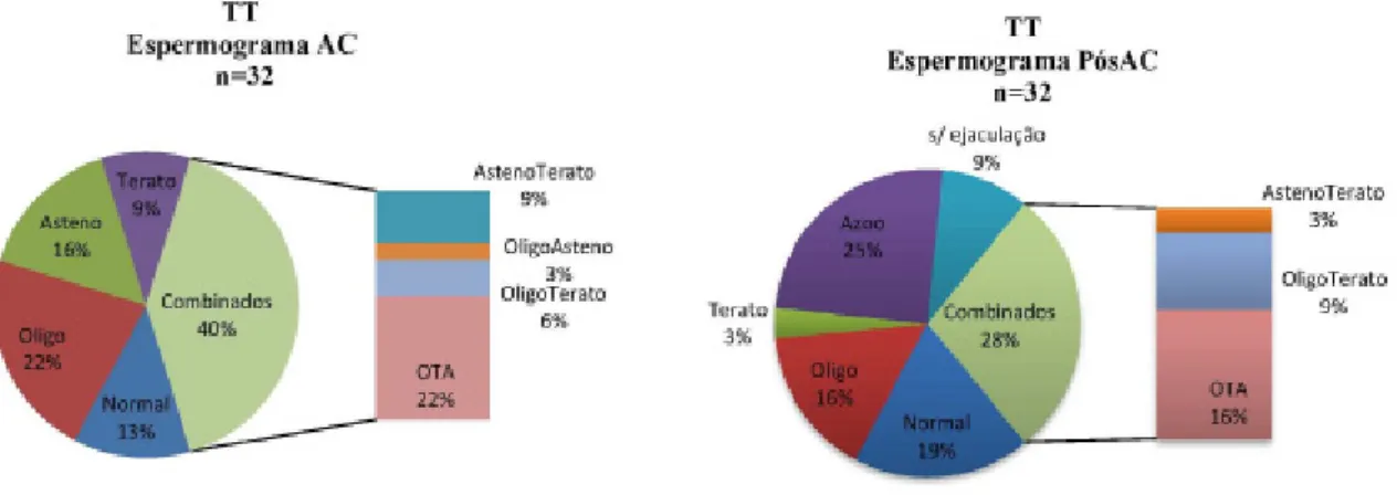 Figura 6 Resultado de espermograma nos doentes com diagnóstico de Tumores do Testículo (TT)  no dia da criopreservação do esperma (AC) e após tratamento oncológico (PósAC)