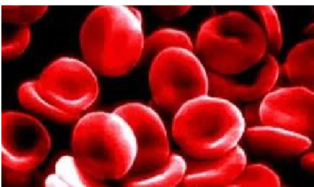Figura 7. Carência de vitamina E nos glóbulos vermelhos.(imagem retirada de http://saude- http://saude-alternativa.blogspot.pt/2012/01/saiba-mais-sobre-anemia-e-remedios.html) 