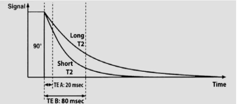 Figure  2  –  Example  of  the  relation  between  T 2  and  TE:  when  TE  is  short,  there  are  no  significant  differences  between  T 2   values;  when  TE is long,  there are different  T 2  values  and  hence  different signals  (Weishaupt  et  al