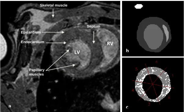 Figure  3  –  Image  of  mid-ventricular  slice  of  IR30/24h  mouse:  a)  3D  anatomical  image  of  the  left  ventricle;  b)  segmentation of the endocardial and epicardial borders, septum and skeletal muscle areas; c)  thresholded mask  divided into si