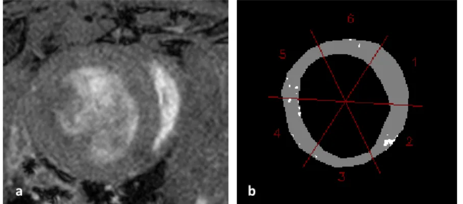 Figure 9 shows the image of one IR30/16h mouse (9a) before the injection of the MPIO and its  thresholded  mask  (9b)
