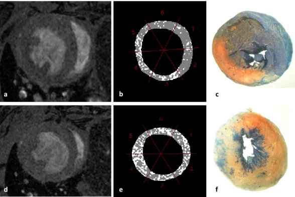 Figure  10  –  Post-MPIO  mid-ventricular  slice  images  (a;  d)  of  one  IR30/16h  mouse  and  respective  thresholded  masks,  considering  skeletal  muscle  as  ROI  and  threshold  value  of  Mean (ROI) +0xSD (ROI) ,  (b;  e)  and  corresponding  his
