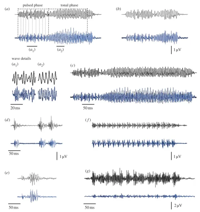 Figure 1. Oscillograms of each sound stimulus (upper black trace) and corresponding auditory evoked response (lower blue trace) recorded from H