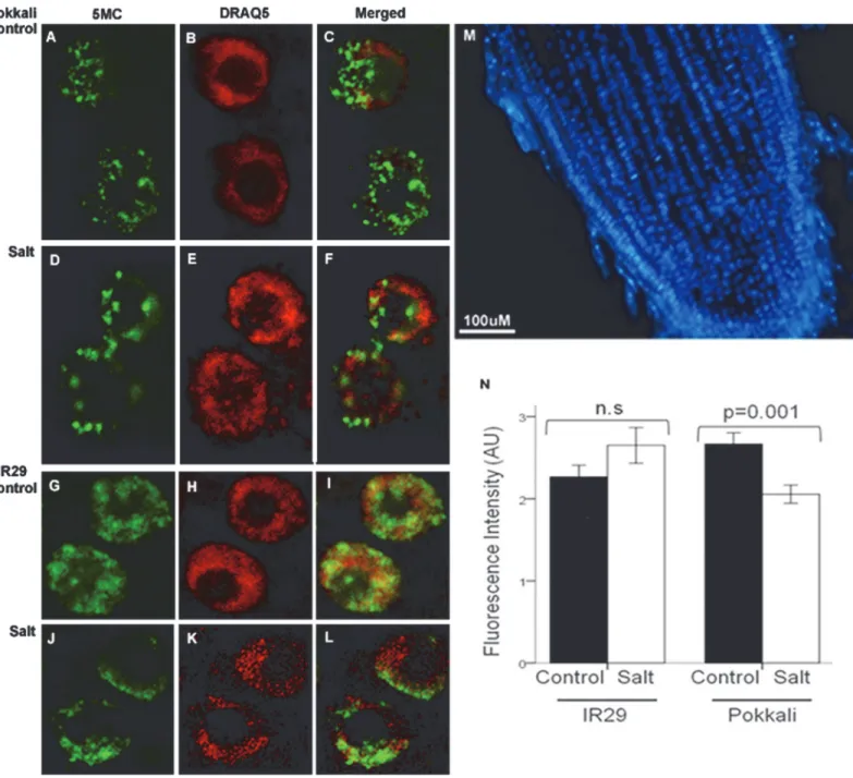 Fig 2. 3D imaging of DNA methylation in single interphase nuclei. Immunofluorescence with a specific antibody against 5-methylcytosine was performed in rice root sections of ‘ Pokkali ’ (A-F) and ‘ IR29 ’ (G-L) 14-days-old seedlings in control conditions o