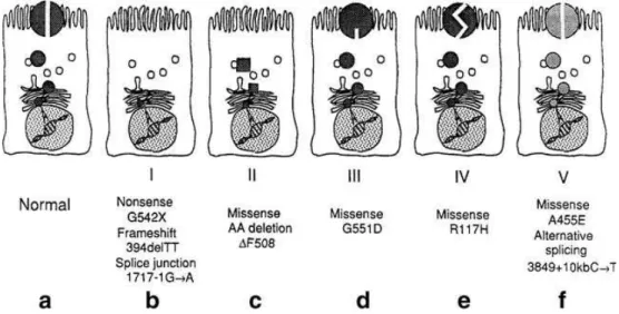 Figure I.5 Molecular consequences of mutations in the CFTR gene. a) CFTR protein correctly  positioned  at the  apical membrane of an epithelial cell, functioning as  a chloride  channel