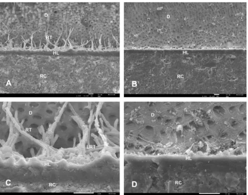 Figure 1. SEM micrographs of bonding interface of the commercial adhesives when ER was applied.