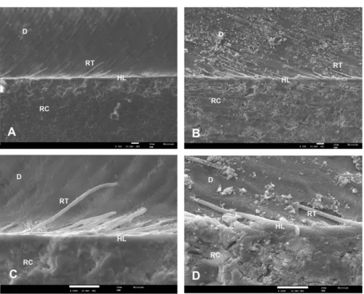 Figure 3. SEM micrographs of the bonding interface of the commercial adhesives when SE was applied.