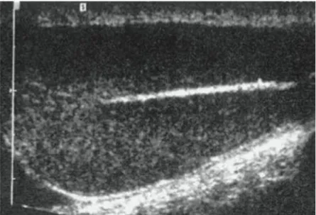 Figura 13 – Testículo normal de canídeo. Imagem do eixo longo do órgão  onde se evidencia a estrutura grosseiramente granular e a presença de uma  estrutura linear hiperecogénica (mediastinum testis) (Adaptado de Dickie,  2006) 