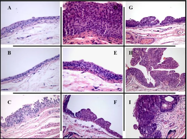 Figure 3. Microscopic histomorphology (H &amp; E). The typical bladder from control group  (A) and control groups with COS (B) treated-rats had no signs of pre-neoplasic lesions or  gross tumor formation