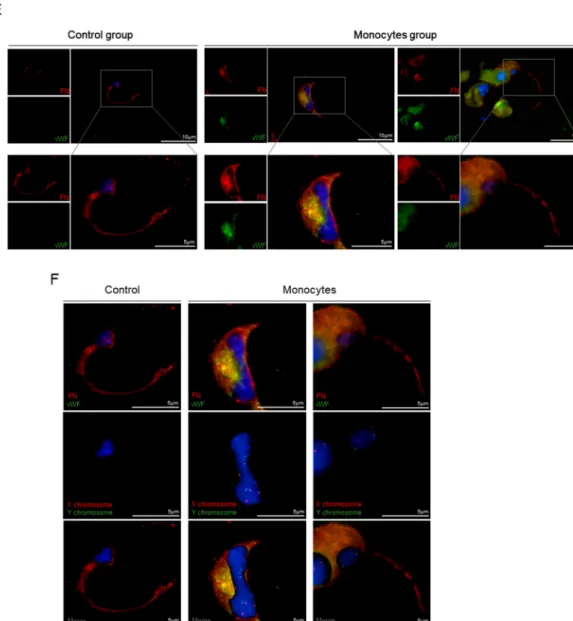 Figure 3. Monocytes exposed to VEGF are able to form blood vessels in vivo. (A) Plug images 21 days after monocyte inoculation in matrigel with VEGF