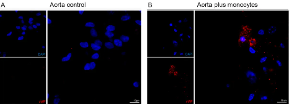 Figure 4. Monocytes are able to be incorporate in the aorta ex vivo, after endothelial Lipopolyssacharides/Lysophosphatidic acid (LPS/LPA)-related injury