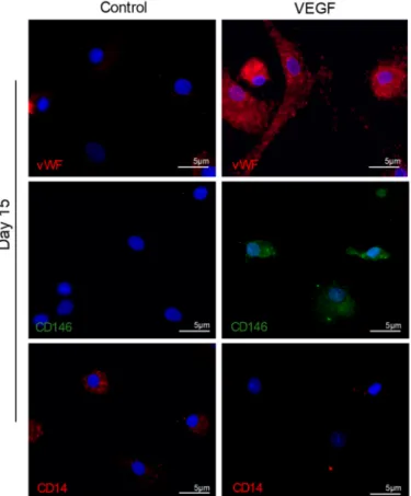 Figure 1. Cultured monocytes undergo an increase in the expression of endothelial cells (ECs) markers and acquire spindle cell like morphology, indicating EC differentiation of monocytes
