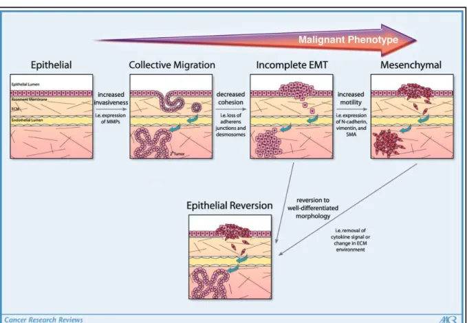 Figure 5 - Epithelial to malignant transition encompasses a wide range of metastatic  phenotypes