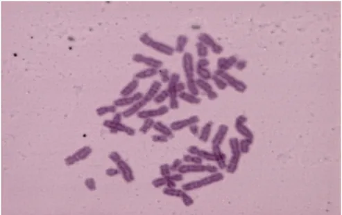 Figura 9. Cromossomas dos fibroblastos de um indivíduo não AF. Não se observam quebras nem  figuras cromatídicas