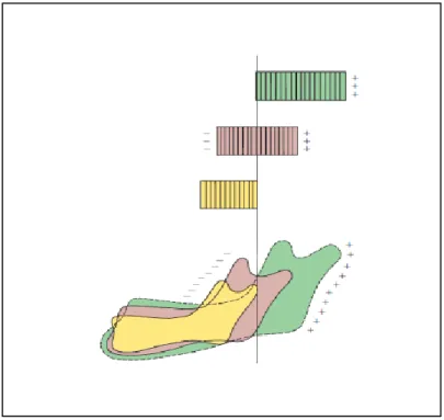 Figura 5 - Crescimento mandibular. O símbolo “+” representa as zonas de formação de osso e o “-“ representa as  zonas de reabsorção (Adaptado de Proffit et al., 2008) 