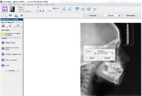 Figura 8 - Calibração das telerradiografias 