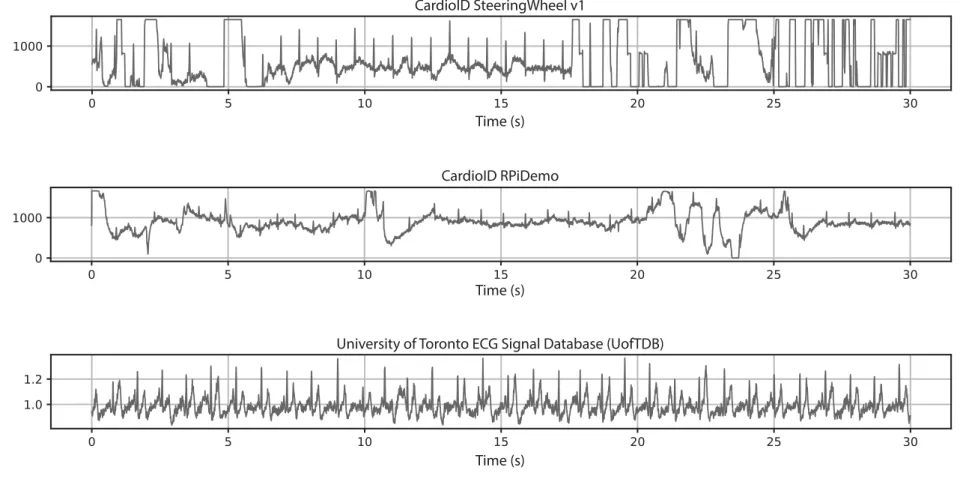Figure 6.2: Example excerpts from the ECG databases used in this dissertation.