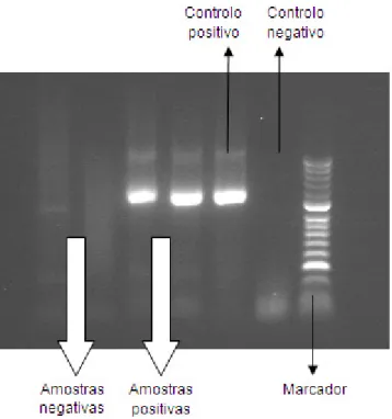 Figura 5- Electroforese em gel de agarose após nested-PCR do gene ompA de C. trachomatis.
