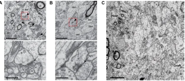 Figure 3.6 No teratomas developed in the human grafts. 