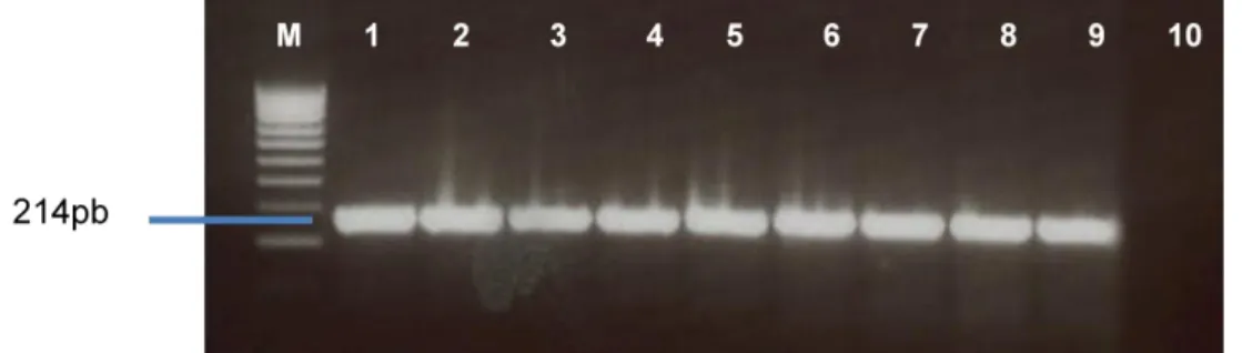 Figura 7 - Exemplo de eletroforese em agarose de produtos de PCR para deteção de invA 
