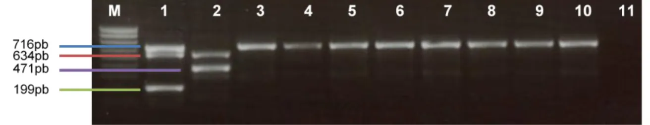 Figura 8 - Exemplo de eletroforese em agarose dos produtos do multiplex PCR de deteção  de bla TEM , bla SHV  e bla OXA-1 