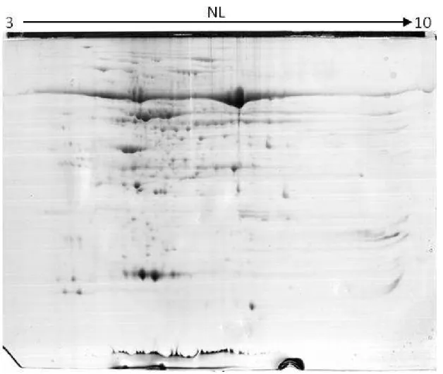 Figure 6: 2-DE gel obtained from 600 µg of protein and CCB stained 