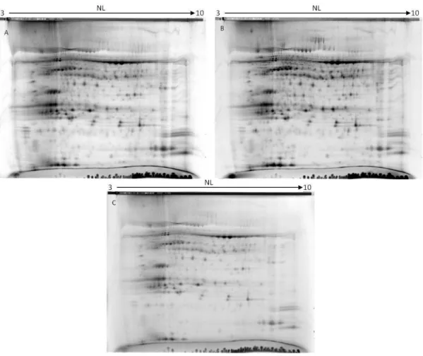 Figure 10: images resulting from one DIGE gel from the B5H/Wt assay; A: B1F control sample marked with Cy 3  Dye; B: Wt treated with 50 µM of cadmium marked with Cy 5 Dye; C: internal standard marked with Cy2 Dye