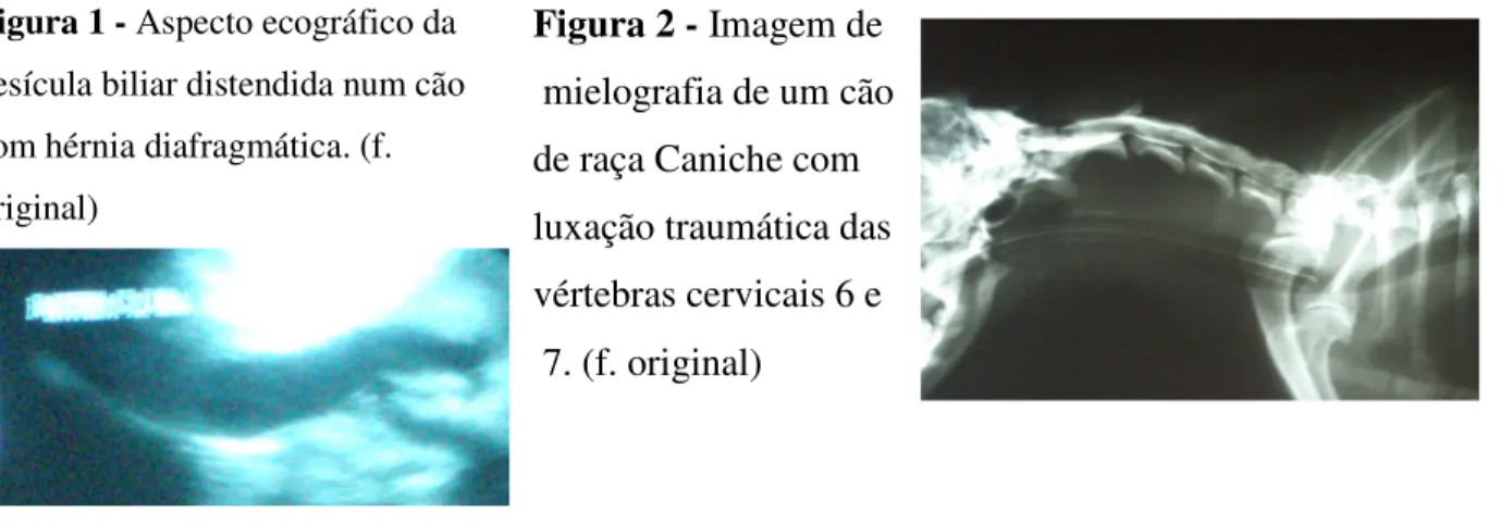 Figura 2 - Imagem de   mielografia de um cão   de raça Caniche com   luxação traumática das   vértebras cervicais 6 e   7