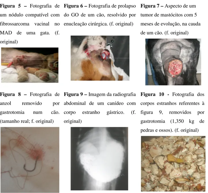 Figura  5  –  Fotografia  de  um  nódulo  compatível  com  fibrossarcoma  vacinal  no  MAD  de  uma  gata