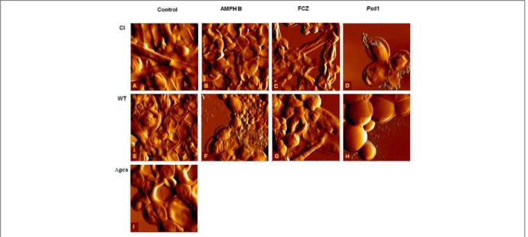 FIGURE 5 | AFM error images of C. albicans strains eradication assays. Clinical isolate (A–D), wild type (E–H) and 1 gcs (I), in the absence of AMPH B (B,F), FCZ (C,G) and Psd1 (D,H) at 10 × MIC
