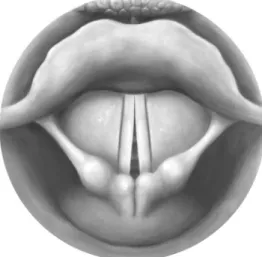 FIGURE 2. - Adduction of the Vocal Folds in MTVD1. 