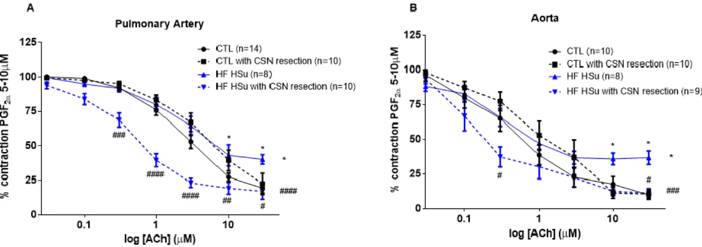 Figure 4.7- Effect of HFHSu diet and of CSN resection in NO levels in plasma. Bars represents mean ± SEM