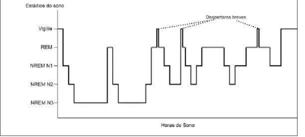 Figura 1. Representação gráfica da sequência dos estádios de sono numa noite (Silva, 2014b)