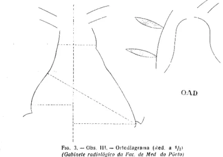 FIG. 3. — Obs. 111. - Ortcdiagrania (lied, a 1/3 1 