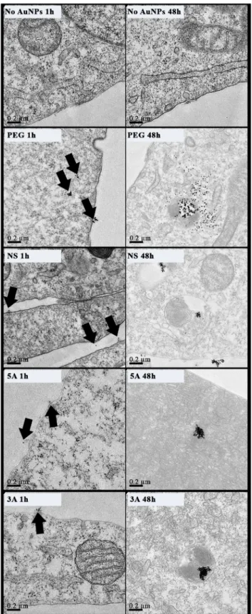 Fig 3. TEM images of MG63 cells treated with GNPs (50nM, 30% PEG) for 1 and 48 hours. Black arrowheads denote GNPs (n = 3 technical replicates; scale bar = 0.2μm).