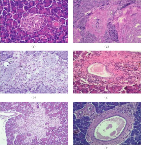 Figure 4: Pancreatic histology at the end of experimental period. Endocrine pancreas (a, b and c): (a) Typical islet from control ZDF (+/+) rats under vehicle treatment, without changes in the endocrine and exocrine pancreas; (b) Extensive fibrosis, vacuol