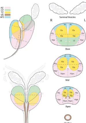 Figure 2.1 Zonal anatomy of the prostate gland, showing the peripheral zone (PZ) in pink, the central zone (CZ) in green, the  transition zone (TZ) in yellow, the urethral sphincter (US) in brown and the anterior fibromuscular stroma (AFS) in blue