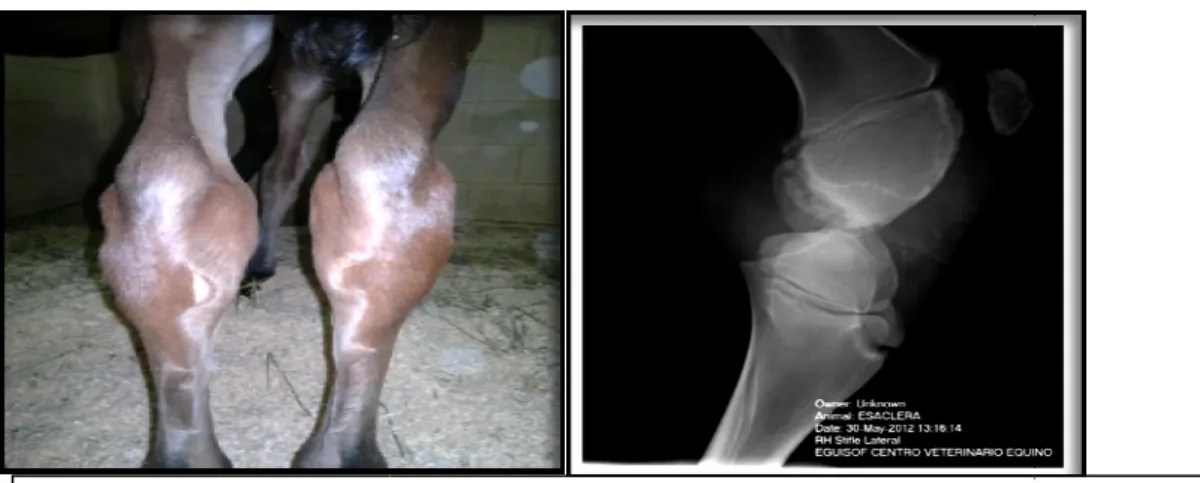 Figura 16 . Distensão articular e imagem radiográfica da lise óssea causada pela artrite séptica (originais)