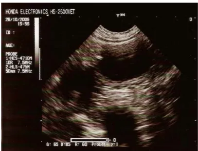 Figura 7 – Ecografia abdominal da “Beatriz”. 