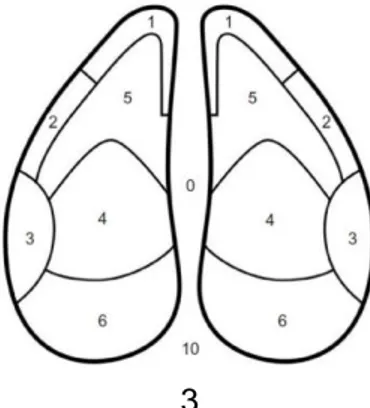 Figure  1 – Claw zone diagram: (1) white line at the toe, (2) abaxial white line, (3) abaxial heel  - wall junction, (4) sole – heel  junction, (5) apex of the sole, and (6) heel (adapt from Risco &amp; Retamal, 2011)