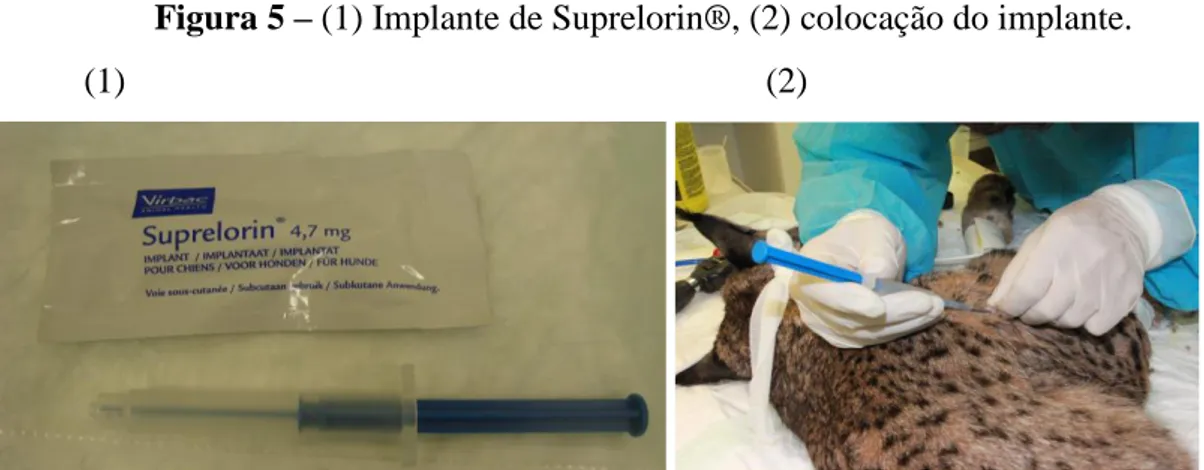 Figura 6 – Após a colocação do implante: (1) zona onde foi colocado o implante, (2)  realização de desinfecção, (3) aplicação de cola de tecidos moles