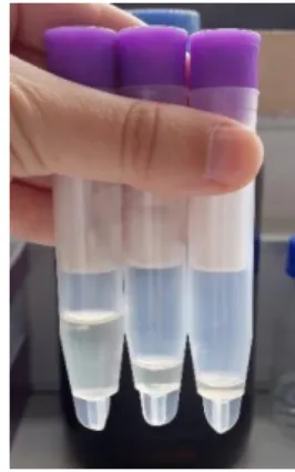 Figura 3 - Diferentes volumes de saliva recuperados após centrifugação de 3 amostras de  saliva 