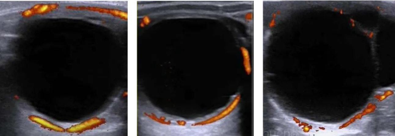 Figura 9 – Imagem representativa de CLs ativos 5 dias após a ovulação. Estas imagens ecográficas foram  recolhidas de distintas éguas