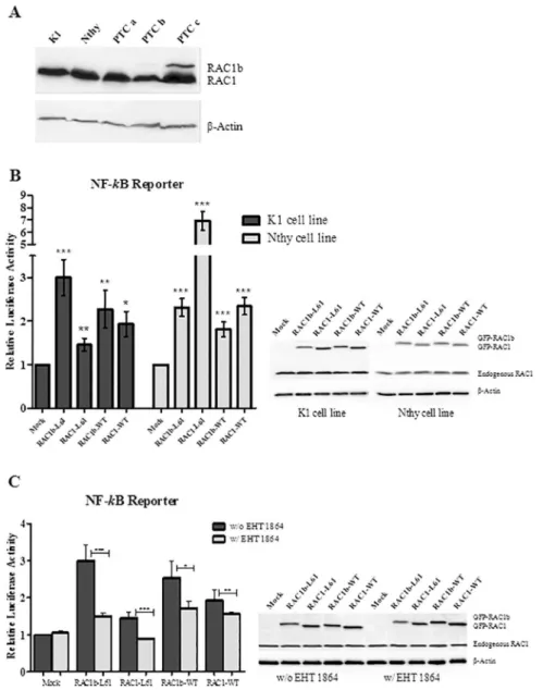 Fig 1. Luciferase activity of NF-kB regulated reporter in transfected K1 and Nthy cells