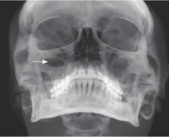 Figura 3: Hupp et al, (2015). 
