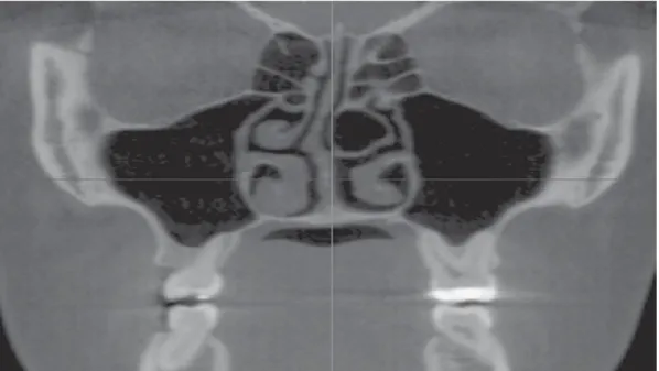 Figura 5: Hupp et al, (2015).  