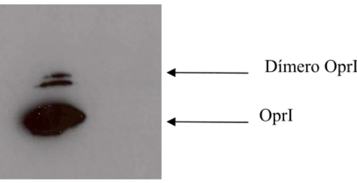 Figura 8 – “Western Blot” correspondente à figura nº 5 (E. 5). Detecção específica da lipoproteína  OprI com o anticorpo monoclonal QB2 (anti-OprI)