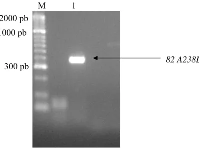Figura 14 – Análise de produtos de amplificação por PCR a partir de colónias transformadas com o  produto de ligação entre o fragmento 82 A238L com o vector pET24aP3BAM14.1 utilizando os 